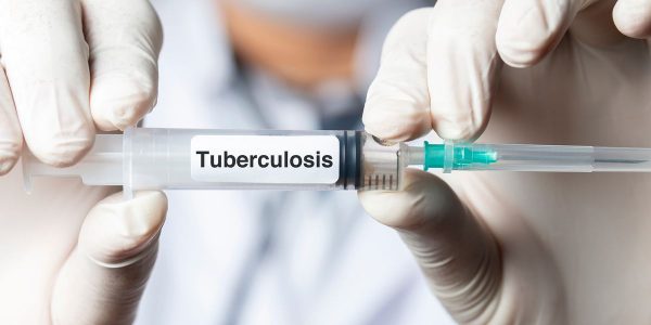 Ogun tuberculosis