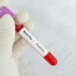 H5N1 Bird Flu WHO